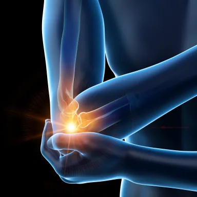 Anatomical illustration of the elbow, with the painful joint highlighted