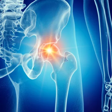 Anatomical illustration of the hip & thigh, with the painful joint highlighted