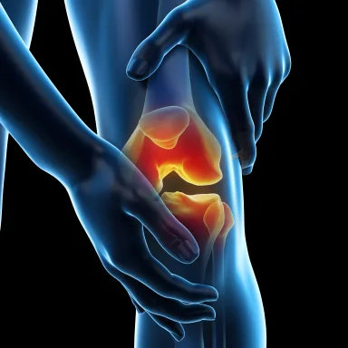 Anatomical illustration of the knee, with the painful joint highlighted