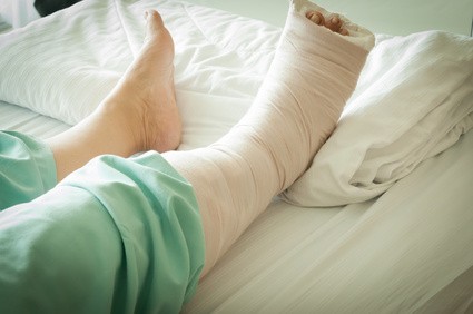 Post Fracture Physiotherapy