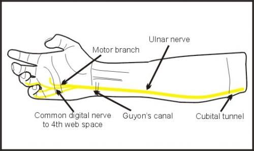 ulnar nerve damage