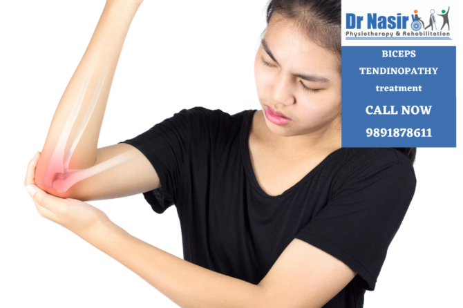 Biceps Tendinitis treatment in Vikaspuri Tilak Nagar Janakpuri