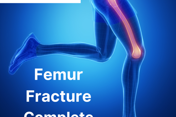 Femur Fracture Treatment in Uttam Nagar