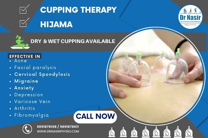 Hijama Therapy In Dwarka Delhi Dr Nasir Physitherapy 91 9891878108