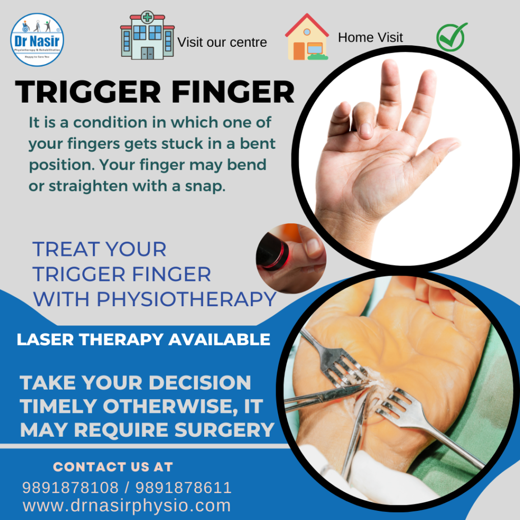 trigger-finger-treatment-near-me-call-dr-nasir-91-9891878108