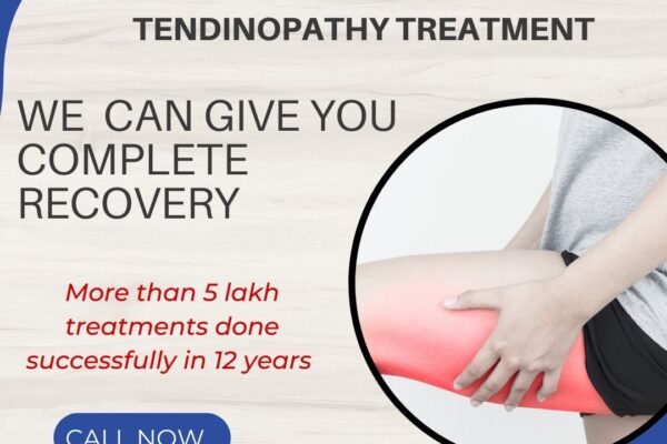 High Hamstring Tendinopathy Treatment near me