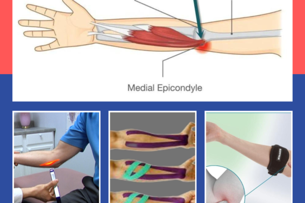 Golfer’s Elbow Treatment near me