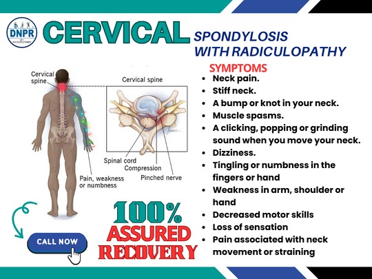 Physiotherapy for Cervical Spondylosis
