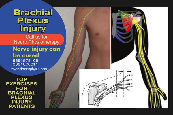 What is Brachial Plexus?