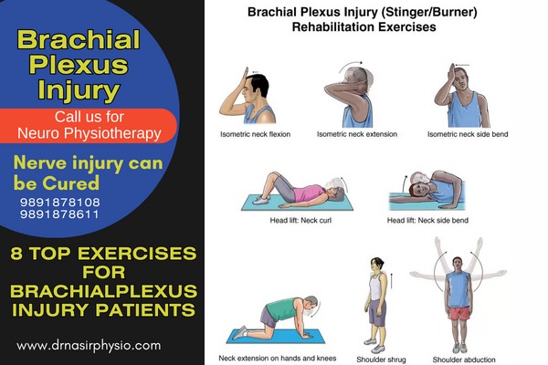 What is Brachial Plexus?